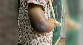 Idosa é resgatada com braço quebrado após filha enfermeira negar ajuda em Goiânia